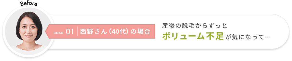 case01 西野さん（40代）の場合　産後の脱毛からずっとボリューム不足が気になって…