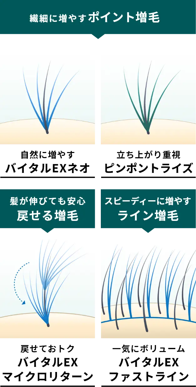 繊細に増やすポイント増毛：自然に増やすバイタルEXネオ＆立ち上がり重視ピンポイントライズ　髪が伸びても安心　戻せる増毛：戻せておトク　バイタルEXマイクロリターン　スピーディーに増やすライン増毛：一気にボリューム　バイタルEXファストライン