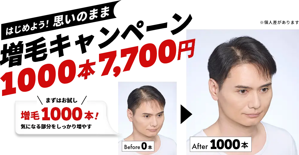 はじめよう！思いのまま増毛キャンペーン　1000本7,700円　まずはお試し　増毛1000本！気になる部分をしっかり増やす