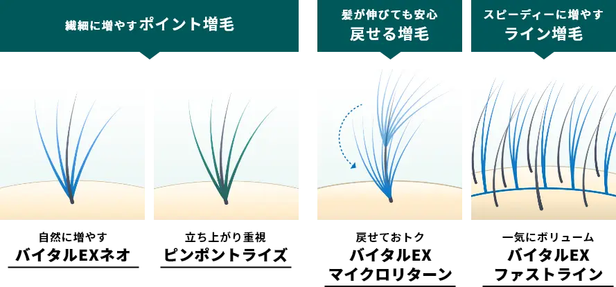 繊細に増やすポイント増毛：自然に増やすバイタルEXネオ＆立ち上がり重視ピンポイントライズ　髪が伸びても安心　戻せる増毛：戻せておトク　バイタルEXマイクロリターン　スピーディーに増やすライン増毛：一気にボリューム　バイタルEXファストライン